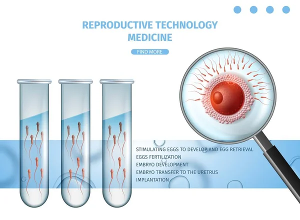 Reproduktiv teknik medicin. IVF stöd banner — Stock vektor