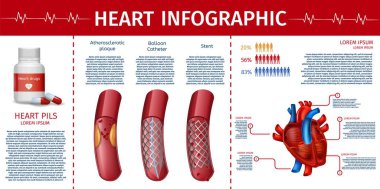 Heart and Cardiovascular Therapy Infographic Page clipart