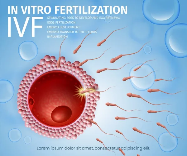 Клітини сперматозоїдів течуть до жіночого яйця . — стоковий вектор