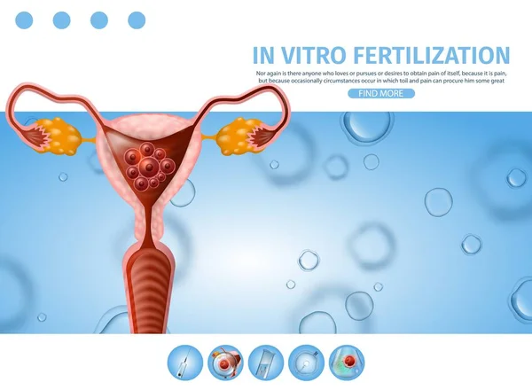 In vitro megtermékenyítés információs támogatás banner. — Stock Vector