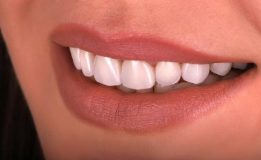 Mükemmel sağlıklı dişler güzel geniş gülümseme ağartma prosedürü genç gülümseyen seksi dudaklı kadının beyazlatılması. Diş Yenileme Tedavisi Oral Bakım Diş Hekimliği, Stomatoloji Dişçiliği 