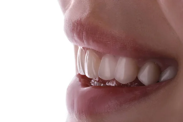 Idealne Zdrowe Zęby Piękny Szeroki Uśmiech Wybielanie Zabieg Wybielanie Młodych — Zdjęcie stockowe