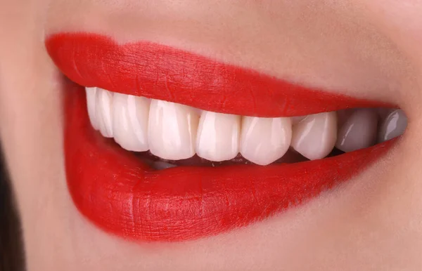 完璧な健康的な歯美しい広い笑顔漂白手順若い笑顔魅力的なセクシーな赤い唇の女性のホワイトニング 歯科修復治療口腔ケアを閉じます 歯科歯科 — ストック写真