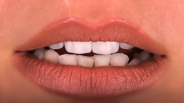 Идеально Здоровые Зубы Красивая Широкая Процедура Отбеливания Улыбки Отбеливание Молодых — стоковое фото