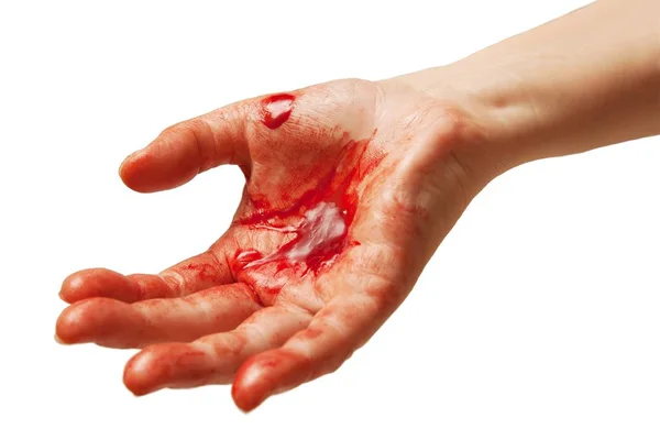 Sangue Nas Mãos Isolado Fundo Branco — Fotografia de Stock