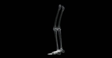 İnsan vücudundaki bacak kemiklerinin hologramı - döngü