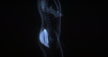 İnsan vücudunda gluteus Maximus. Röntgen. Döngü