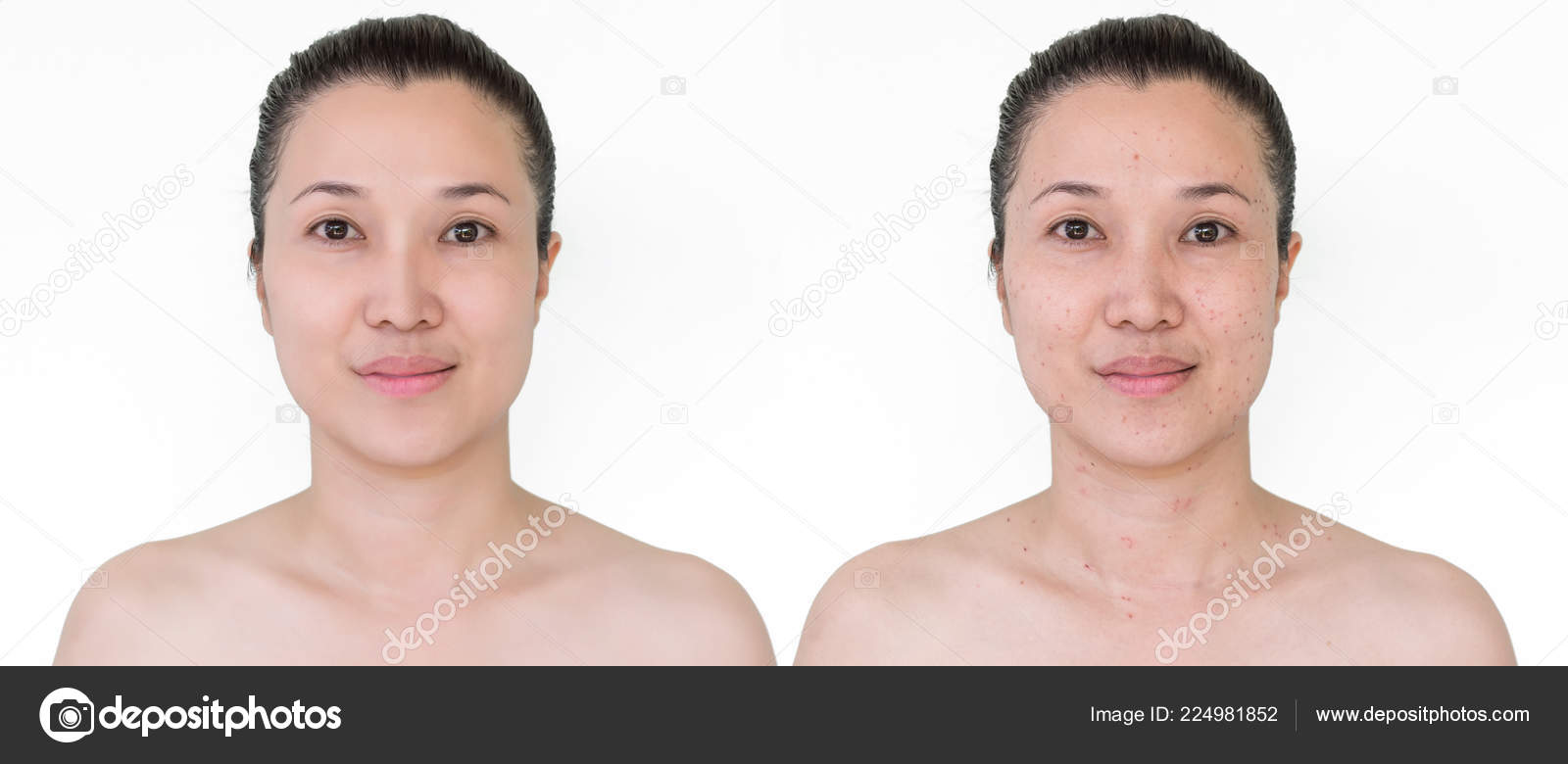 értelmes szépség anti aging rendszer