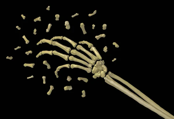 Skeletarm Botten Kleine Stukjes Exploderen Abstract Illustratie Horizontaal Zwart Geïsoleerd — Stockfoto