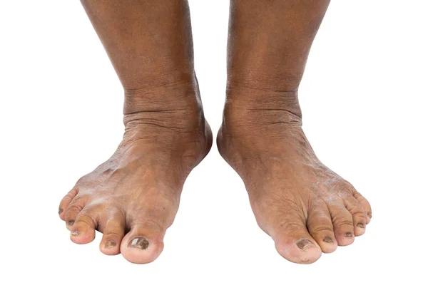 Füße Der Seniorin Isoliert Auf Weißem Hintergrund — Stockfoto