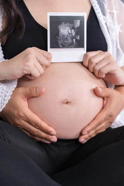 Hamile Kadın Kocasıyla Ultrason Holding — Stok fotoğraf