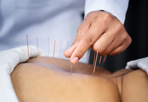 Gros plan du dos de la femme âgée avec des aiguilles en acier pendant la procédure — Photo