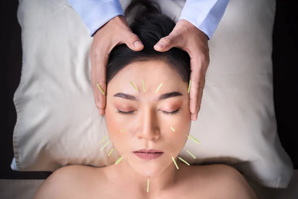 Akupunktúrás kezelés alatt álló nő az arcon — Stock Fotó