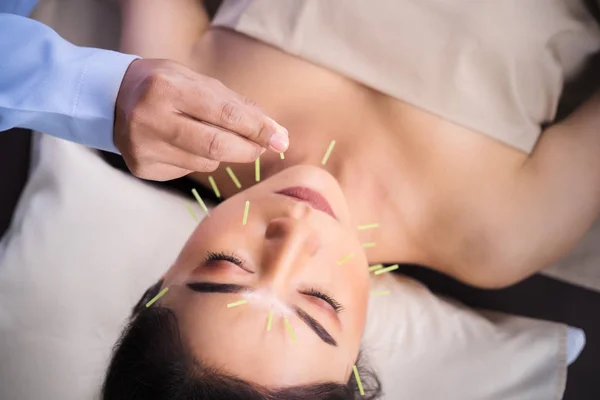 Femme en traitement d'acupuncture sur le visage — Photo