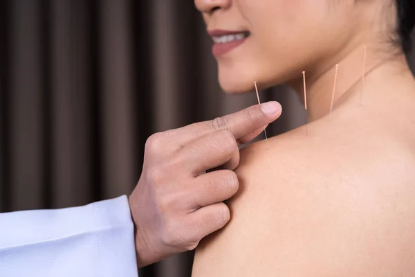 Kobieta w trakcie leczenia akupunkturą na ramieniu — Zdjęcie stockowe