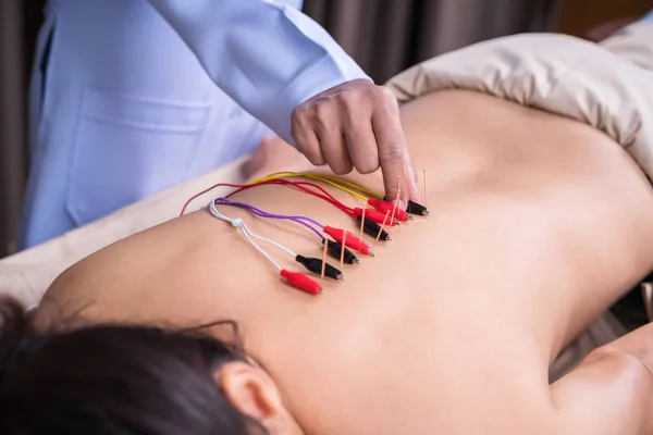 Femme subissant un traitement d'acupuncture avec stimulato électrique — Photo