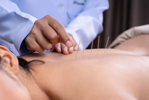 Akupunktúrás kezelés alatt álló nő hátán — Stock Fotó