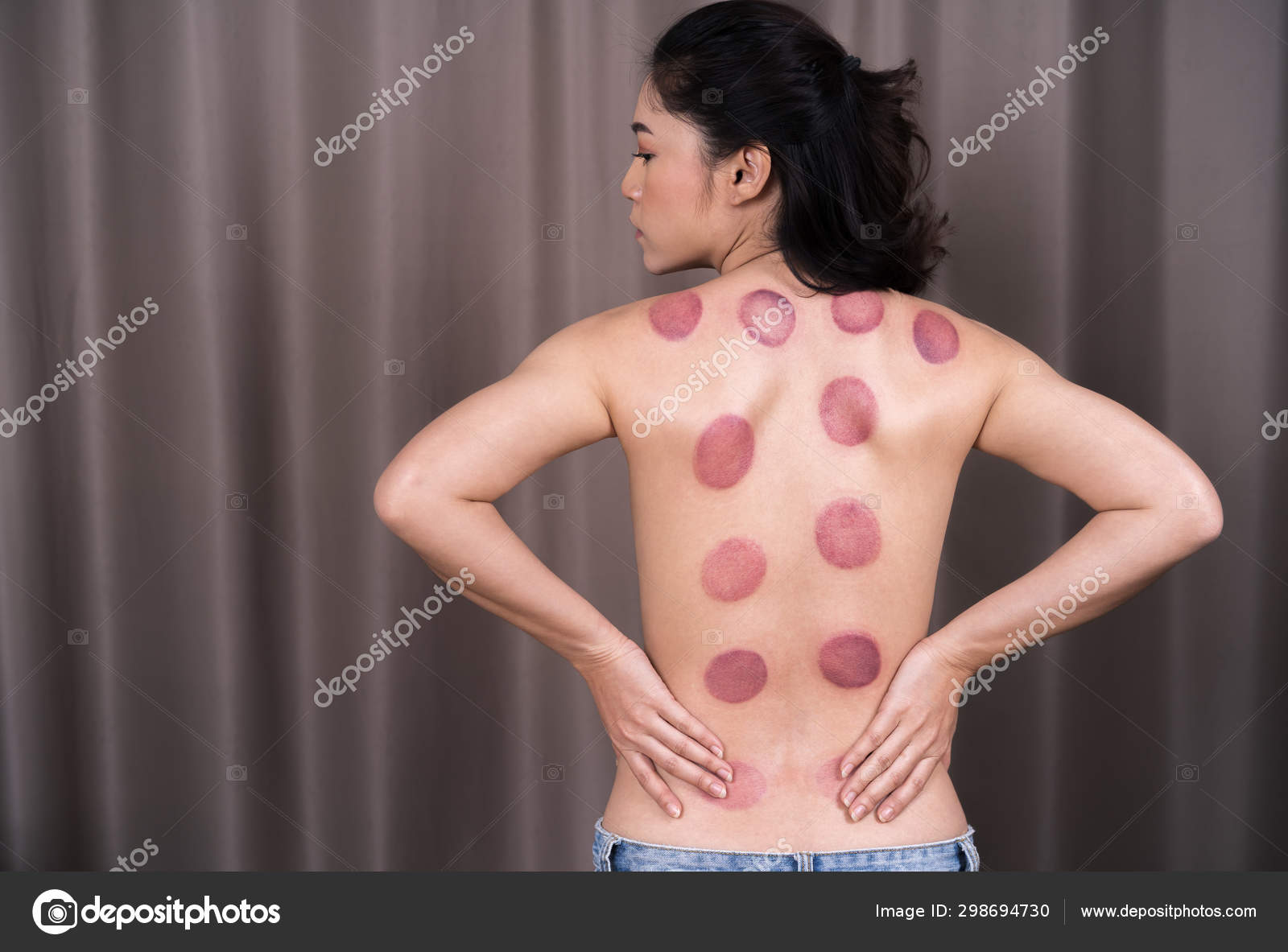 Mujer recibiendo tratamiento de ventosa en la espalda — Foto de