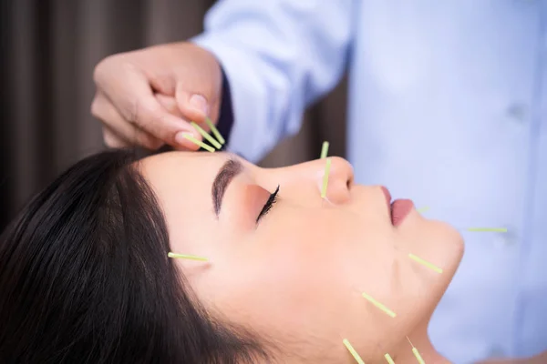Femme en traitement d'acupuncture sur le visage — Photo