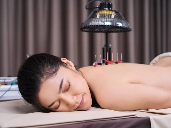 woman undergoing acupuncture treatment with electrical stimulato