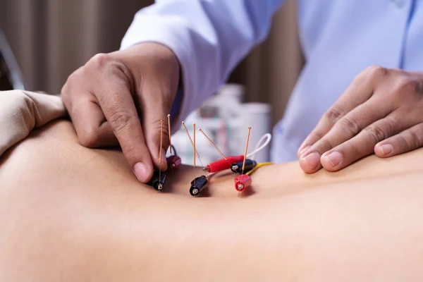 Femme subissant un traitement d'acupuncture avec stimulato électrique — Photo