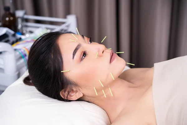 Kobieta poddawani leczeniu akupunktury na twarzy — Zdjęcie stockowe