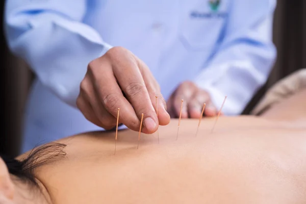 Žena procházející akupunkturou na zádech — Stock fotografie