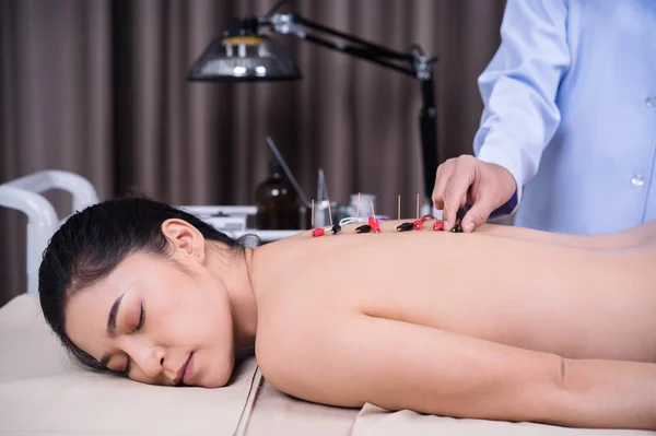 woman undergoing acupuncture treatment with electrical stimulato