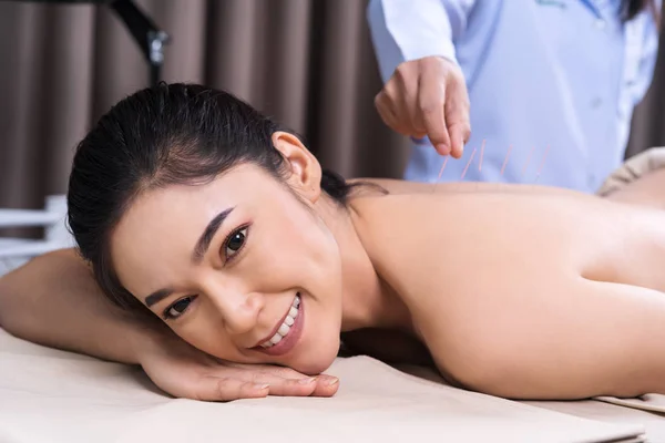 woman undergoing acupuncture treatment on back