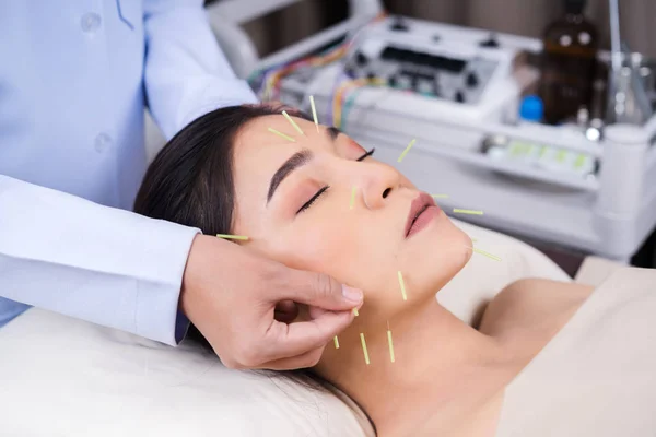 Akupunktúrás kezelés alatt álló nő az arcon — Stock Fotó
