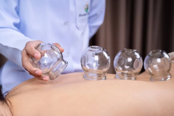 Mulher recebendo tratamento de Cupping nas costas — Fotografia de Stock