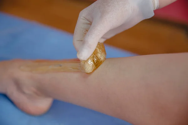 the master of sugaring in gloves puts paste on the clients leg in the salon. The procedure of sugar hair removal