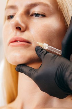 Eldivenli doktor dudaklarına botoks yapıyor.