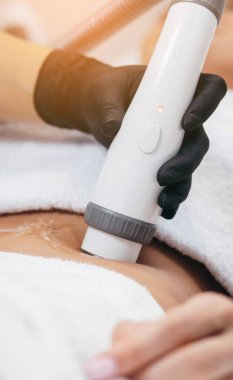 Saç lazeri temizleme servisi. IPL kozmetoloji aygıtı. 