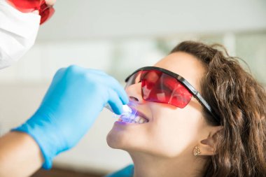 Close-up of young woman having her teeth whitened with ultraviolet light in dental clinic clipart
