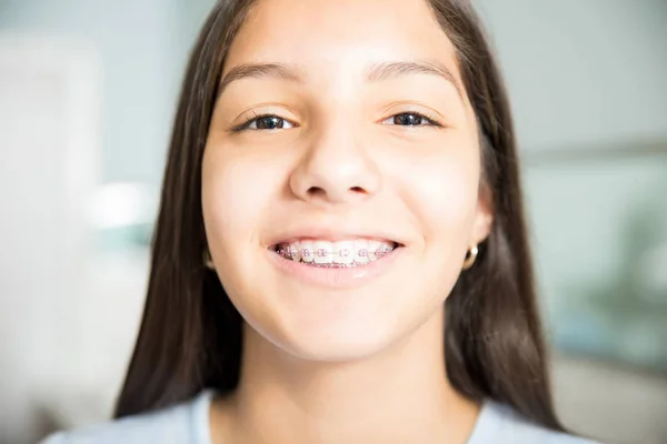 Портрет Усміхненої Дівчини Підлітка Брекетах Стоматологічній Клініці — стокове фото