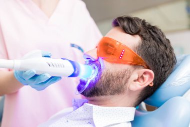 Lekeleri ve renk değişikliğikaldırmak için lazer diş beyazlatma tedavisi gören adam closeup