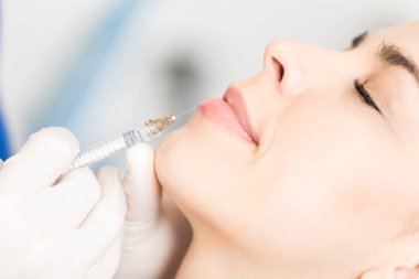 Cilt bakım kliniğinde şekli artırmak için dolgu maddeleri closeup kadın dudak dermal tabaka içinde itilir