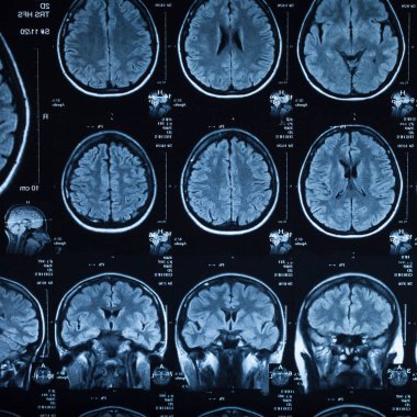 İnsan beyninin, portre resim tıbbi x-ray