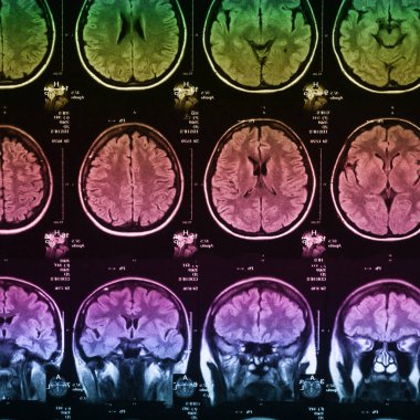 İnsan beyninin, portre resim tıbbi x-ray