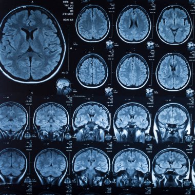 İnsan beyninin, portre resim tıbbi x-ray