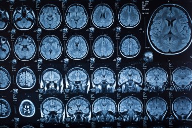 İnsan beyninin, portre resim tıbbi x-ray