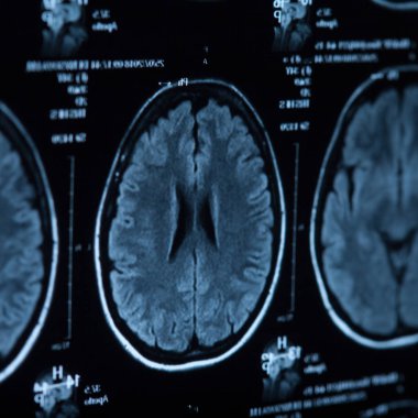 İnsan beyninin, portre resim tıbbi x-ray