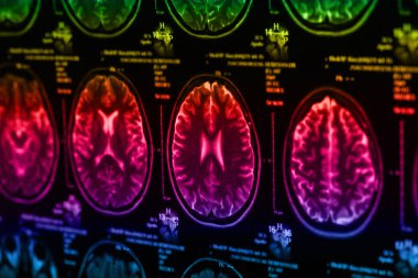 İnsan beyninin, portre resim tıbbi x-ray