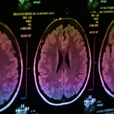 İnsan beyninin, portre resim tıbbi x-ray