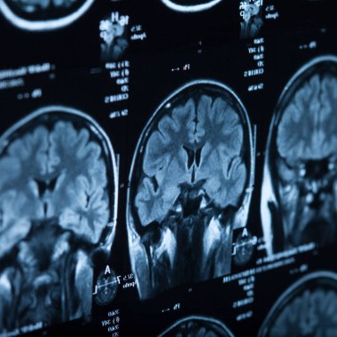 İnsan beyninin, portre resim tıbbi x-ray