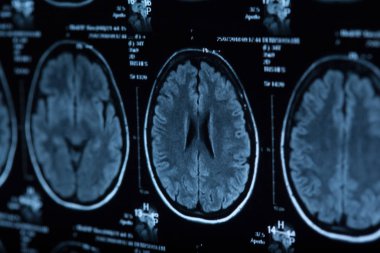 İnsan beyninin, portre resim tıbbi x-ray