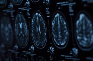 İnsan beyninin, portre resim tıbbi x-ray