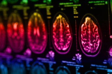 İnsan beyninin, portre resim tıbbi x-ray