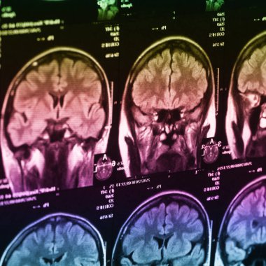 İnsan beyninin, portre resim tıbbi x-ray